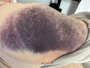 Fisioterapia Avanzada