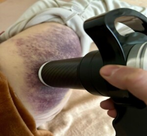 Fisioterapia Avanzada